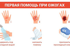 Термический ожог? Правила действий.